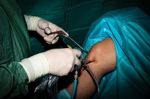 Teqnoir-Arthroscopy-Medicine-Surgery-Knee,Durchführung einer Kniearthroskopie mit Operateur